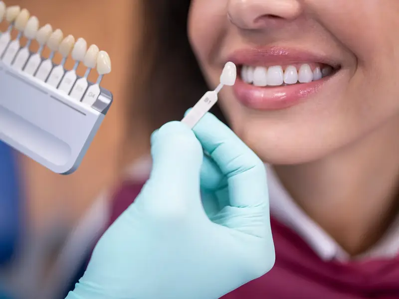 Woman getting fitted for a veneer