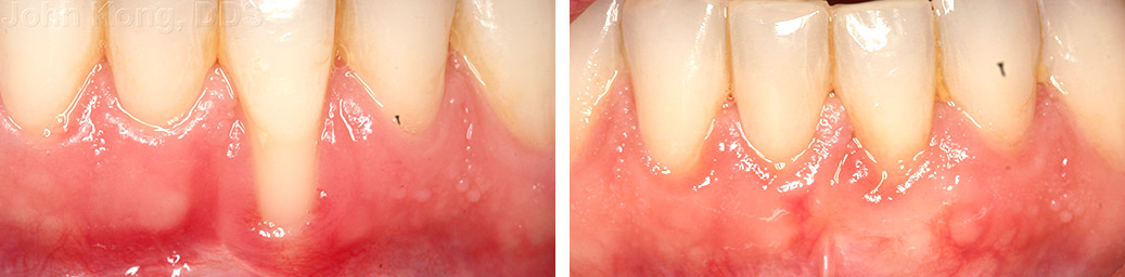 Before and After Case